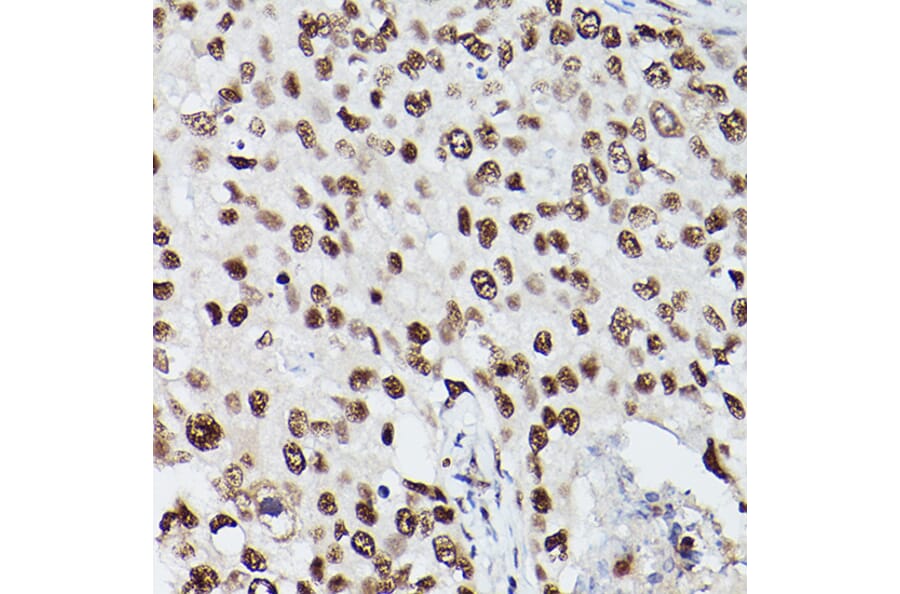 Immunohistochemistry - Anti-PSME3 Antibody (A89331) - Antibodies.com
