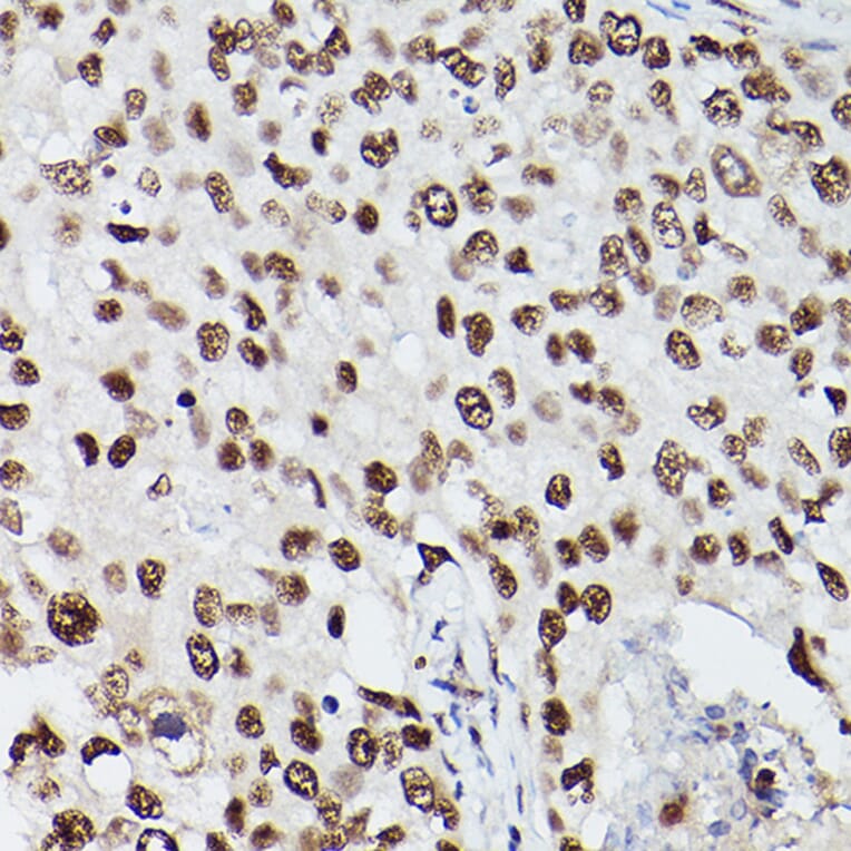 Immunohistochemistry - Anti-PSME3 Antibody (A89331) - Antibodies.com