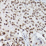 Immunohistochemistry - Anti-PSME3 Antibody (A89331) - Antibodies.com