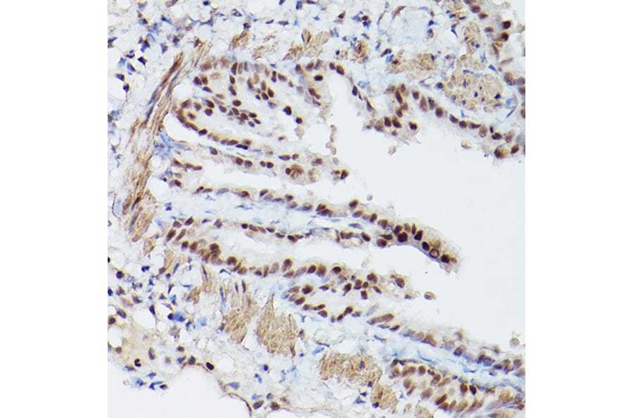 Immunohistochemistry - Anti-PSME3 Antibody (A89331) - Antibodies.com