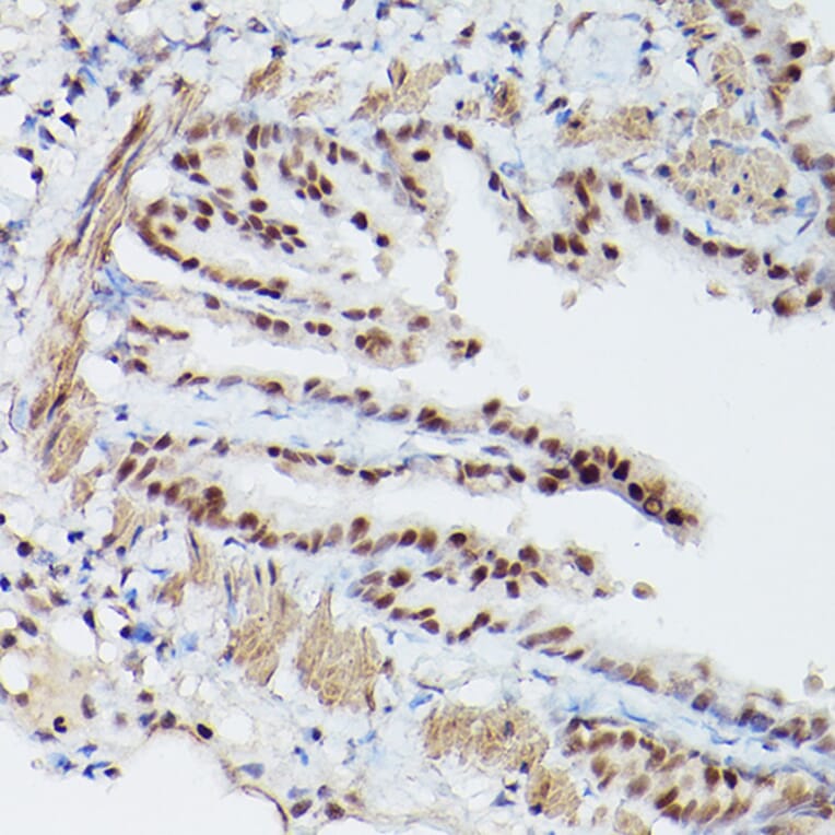 Immunohistochemistry - Anti-PSME3 Antibody (A89331) - Antibodies.com