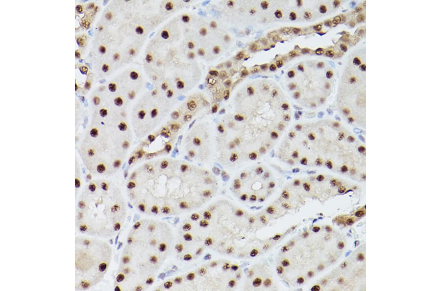 Immunohistochemistry - Anti-PSME3 Antibody (A89331) - Antibodies.com
