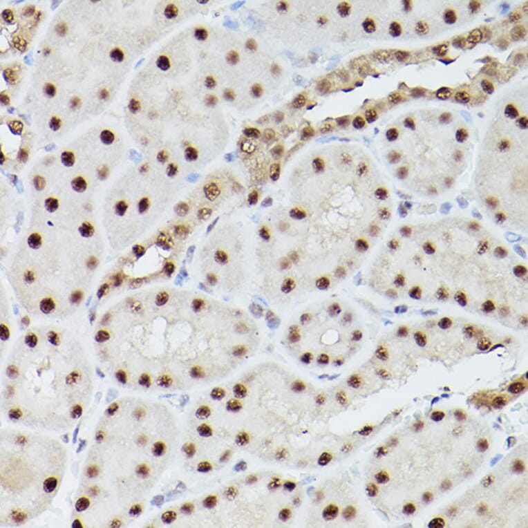 Immunohistochemistry - Anti-PSME3 Antibody (A89331) - Antibodies.com