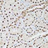 Immunohistochemistry - Anti-PSME3 Antibody (A89331) - Antibodies.com