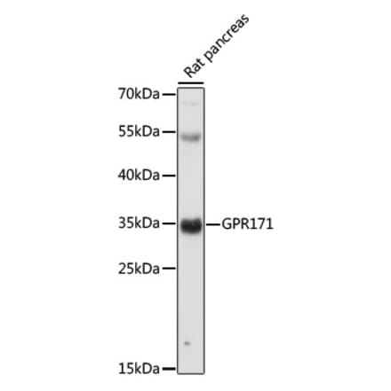 Western Blot - Anti-GPR171 Antibody (A89332) - Antibodies.com