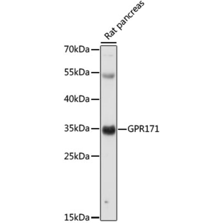 Western Blot - Anti-GPR171 Antibody (A89332) - Antibodies.com