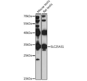 Western Blot - Anti-ANT4 Antibody (A89333) - Antibodies.com