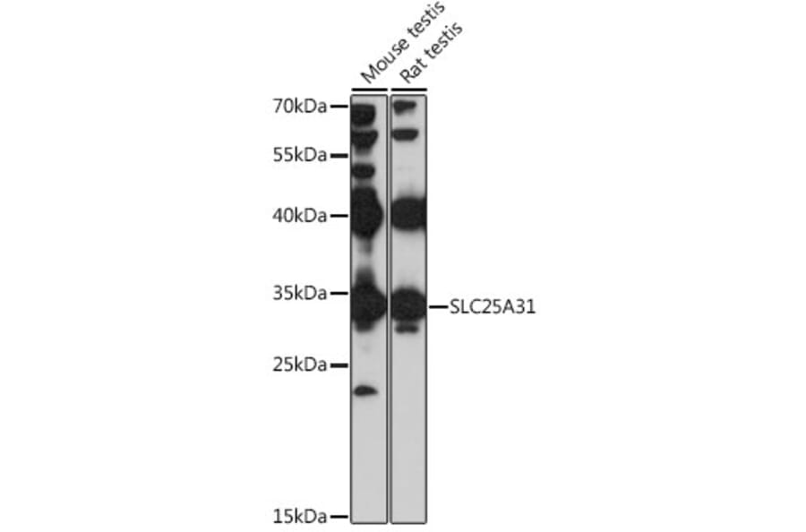 Western Blot - Anti-ANT4 Antibody (A89333) - Antibodies.com