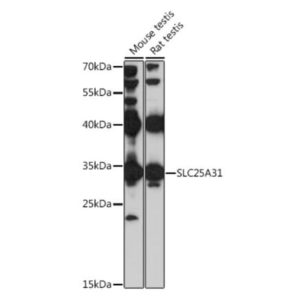 Western Blot - Anti-ANT4 Antibody (A89333) - Antibodies.com
