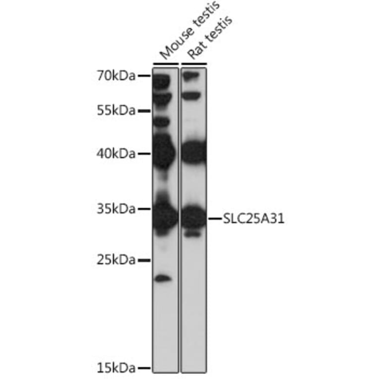 Western Blot - Anti-ANT4 Antibody (A89333) - Antibodies.com