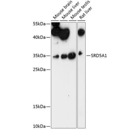 Western Blot - Anti-SRD5A1 Antibody (A89334) - Antibodies.com