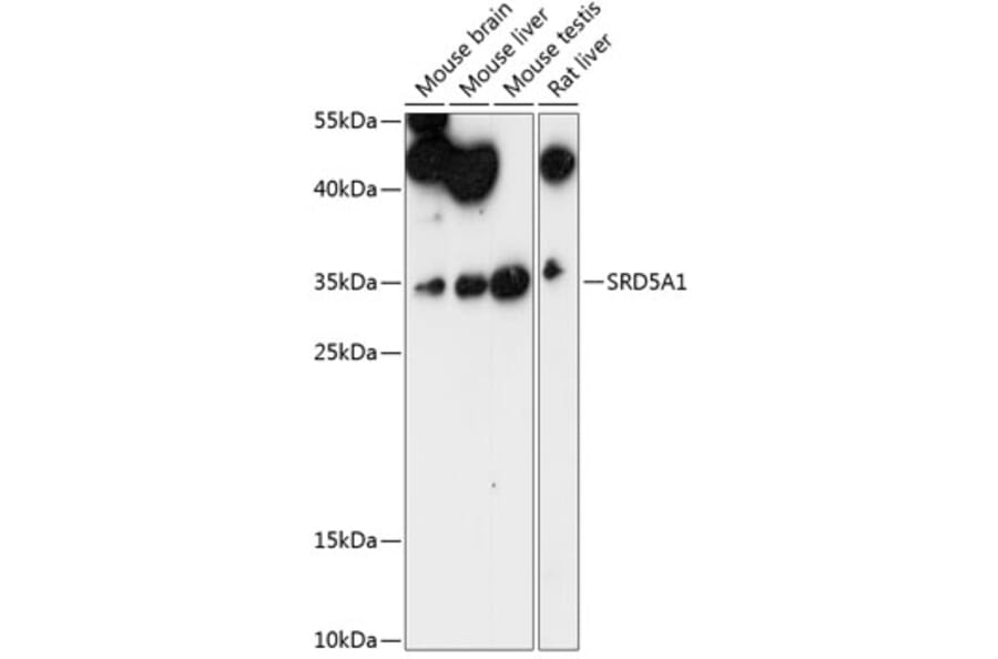 Western Blot - Anti-SRD5A1 Antibody (A89334) - Antibodies.com