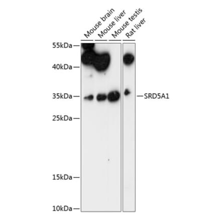 Western Blot - Anti-SRD5A1 Antibody (A89334) - Antibodies.com