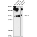 Western Blot - Anti-SRD5A1 Antibody (A89334) - Antibodies.com