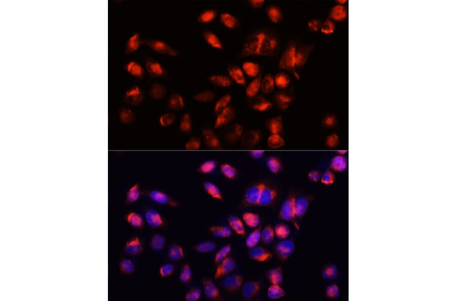 Immunofluorescence - Anti-HAVCR2 Antibody (A13444) - Antibodies.com