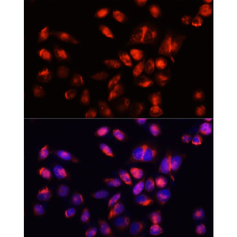 Immunofluorescence - Anti-HAVCR2 Antibody (A13444) - Antibodies.com