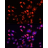 Immunofluorescence - Anti-HAVCR2 Antibody (A13444) - Antibodies.com