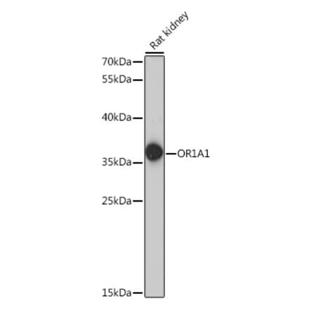Western Blot - Anti-OR1A1 Antibody (A89336) - Antibodies.com