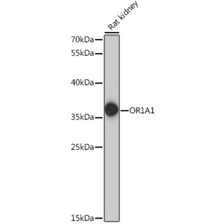 Western Blot - Anti-OR1A1 Antibody (A89336) - Antibodies.com