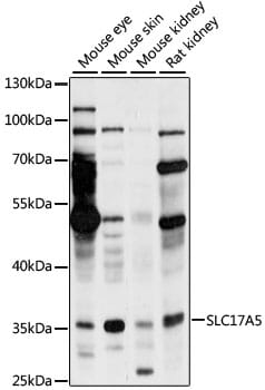 Western blot analysis of extracts of various cell lines, using Anti-SLC17A5 Antibody (A15426) at 1:1,000 dilution.
Secondary antibody: Goat Anti-Rabbit IgG (H+L) (HRP) (AS014) at 1:10,000 dilution.
Lysates / proteins: 25µg per lane.
Blocking buffer: 3% non-fat dry milk in TBST.
Detection: ECL Basic Kit (RM00020).
Exposure time: 60s.