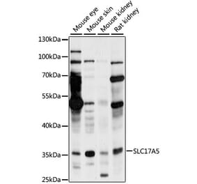 Western Blot - Anti-SLC17A5 Antibody (A89337) - Antibodies.com