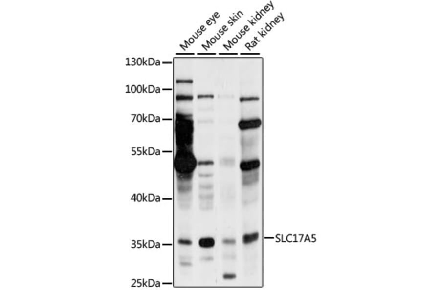 Western Blot - Anti-SLC17A5 Antibody (A89337) - Antibodies.com