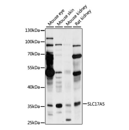 Western Blot - Anti-SLC17A5 Antibody (A89337) - Antibodies.com