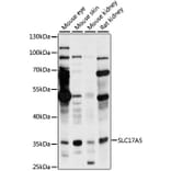 Western Blot - Anti-SLC17A5 Antibody (A89337) - Antibodies.com