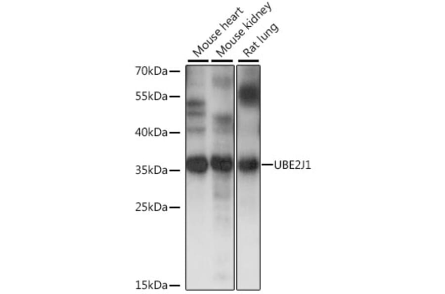 Western Blot - Anti-UBE2J1 Antibody (A89338) - Antibodies.com