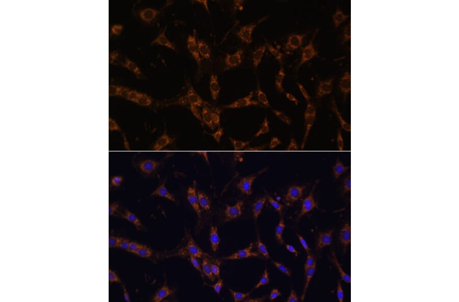 Immunofluorescence - Anti-UBE2J1 Antibody (A89338) - Antibodies.com