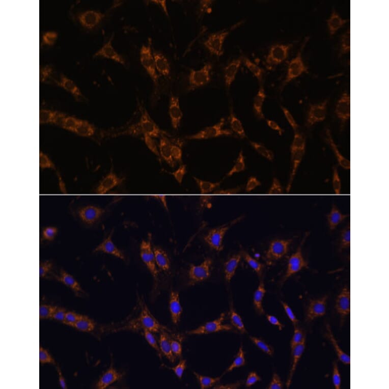 Immunofluorescence - Anti-UBE2J1 Antibody (A89338) - Antibodies.com