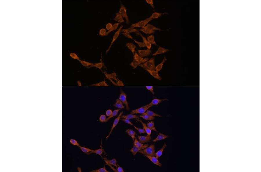 Immunofluorescence - Anti-UBE2J1 Antibody (A89338) - Antibodies.com