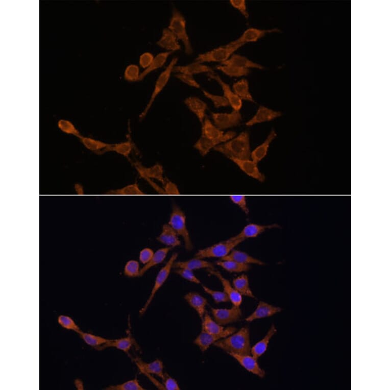 Immunofluorescence - Anti-UBE2J1 Antibody (A89338) - Antibodies.com