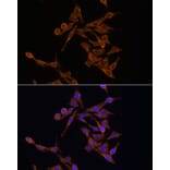 Immunofluorescence - Anti-UBE2J1 Antibody (A89338) - Antibodies.com