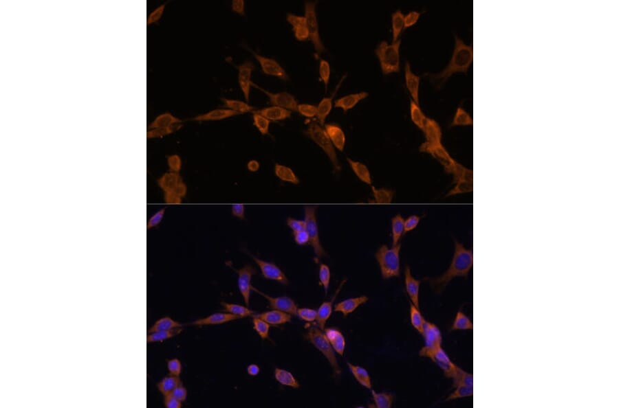 Immunofluorescence - Anti-UBE2J1 Antibody (A89338) - Antibodies.com