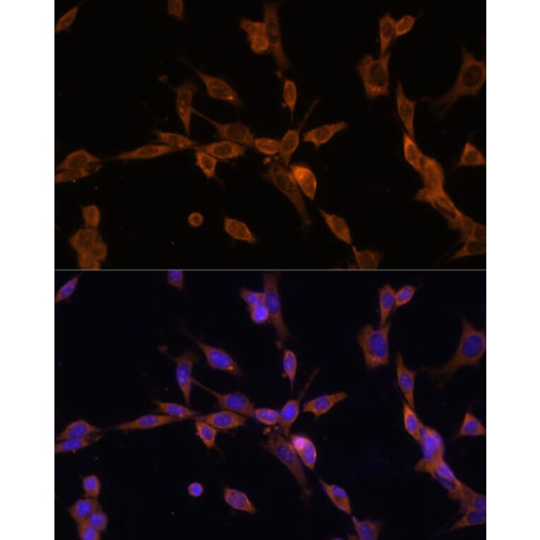 Immunofluorescence - Anti-UBE2J1 Antibody (A89338) - Antibodies.com