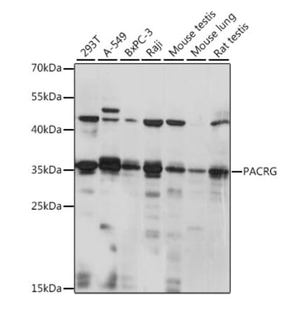 Western Blot - Anti-PACRG Antibody (A89339) - Antibodies.com