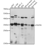 Western Blot - Anti-PACRG Antibody (A89339) - Antibodies.com