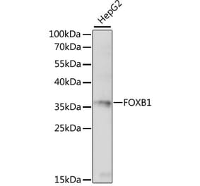 Western Blot - Anti-FOXB1 Antibody (A89340) - Antibodies.com