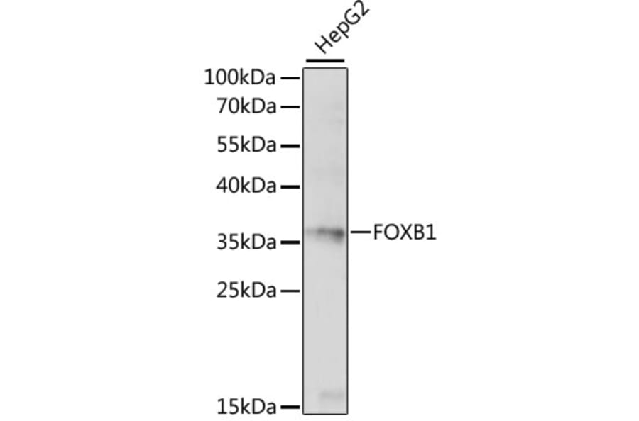 Western Blot - Anti-FOXB1 Antibody (A89340) - Antibodies.com