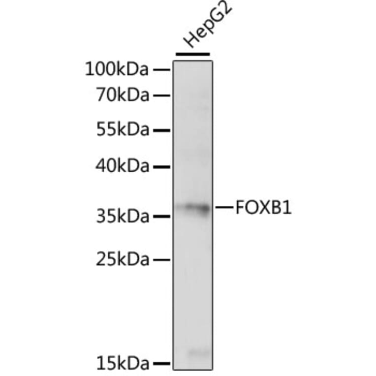 Western Blot - Anti-FOXB1 Antibody (A89340) - Antibodies.com