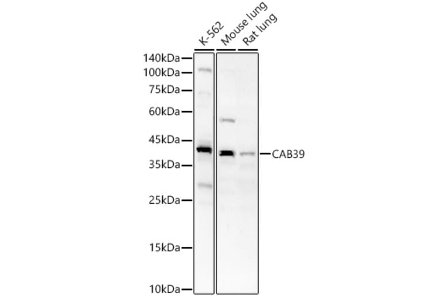 Western Blot - Anti-CAB39/MO25 Antibody (A89341) - Antibodies.com