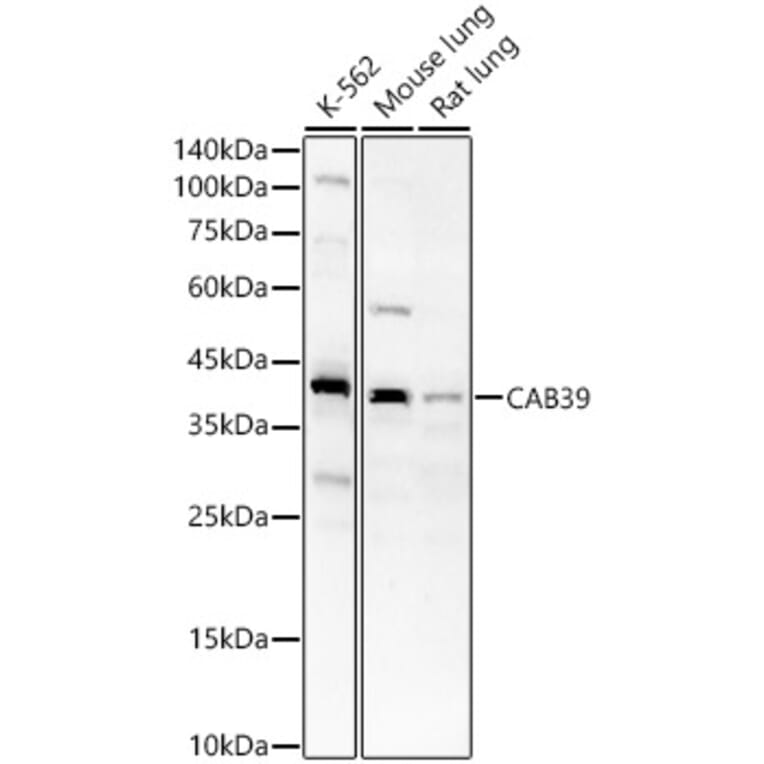 Western Blot - Anti-CAB39/MO25 Antibody (A89341) - Antibodies.com