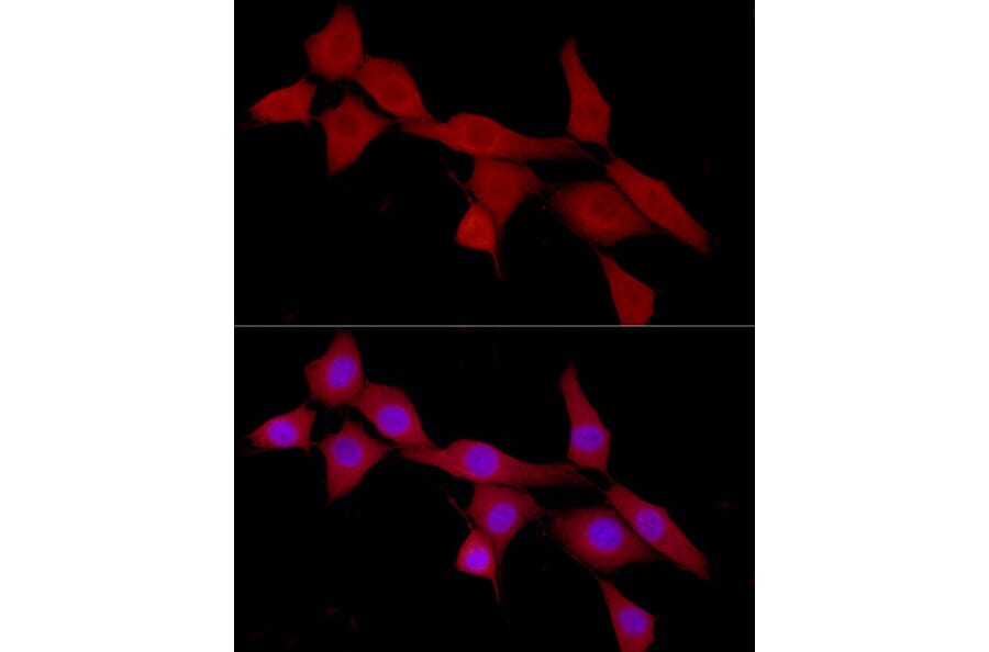 Immunofluorescence - Anti-CAB39/MO25 Antibody (A89341) - Antibodies.com