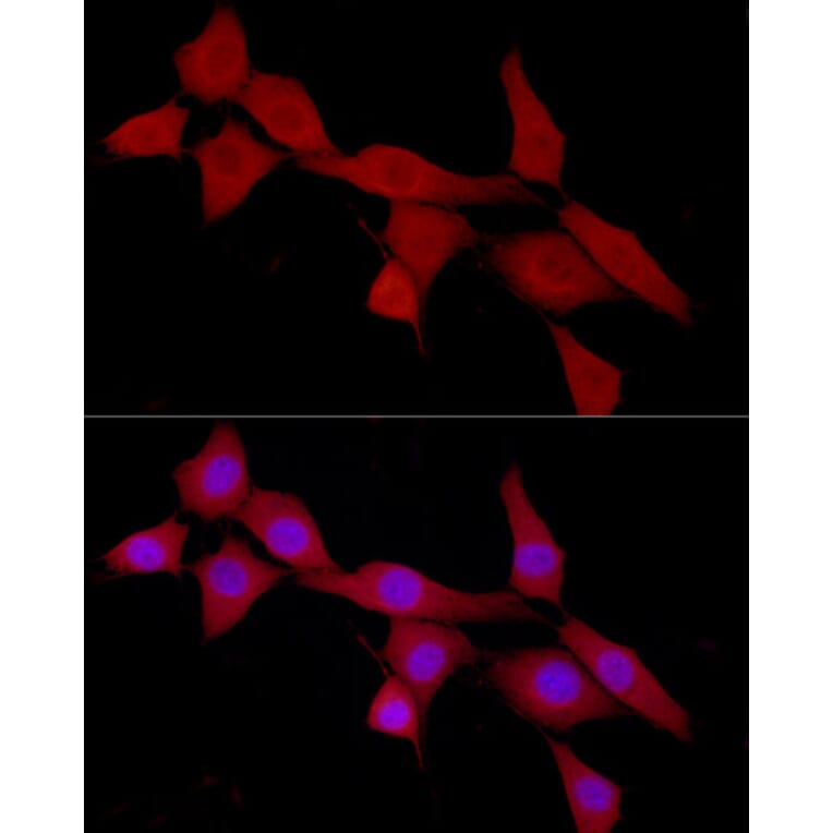 Immunofluorescence - Anti-CAB39/MO25 Antibody (A89341) - Antibodies.com