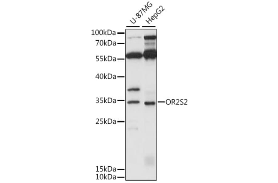 Western Blot - Anti-OR2S2 Antibody (A89342) - Antibodies.com
