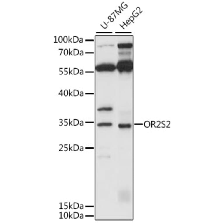 Western Blot - Anti-OR2S2 Antibody (A89342) - Antibodies.com