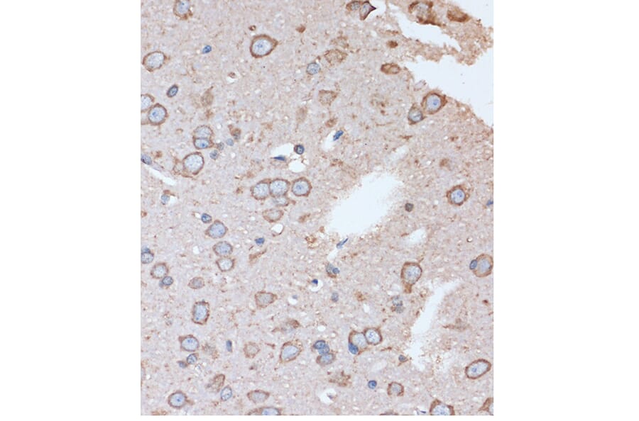 Immunohistochemistry - Anti-OR2S2 Antibody (A89342) - Antibodies.com