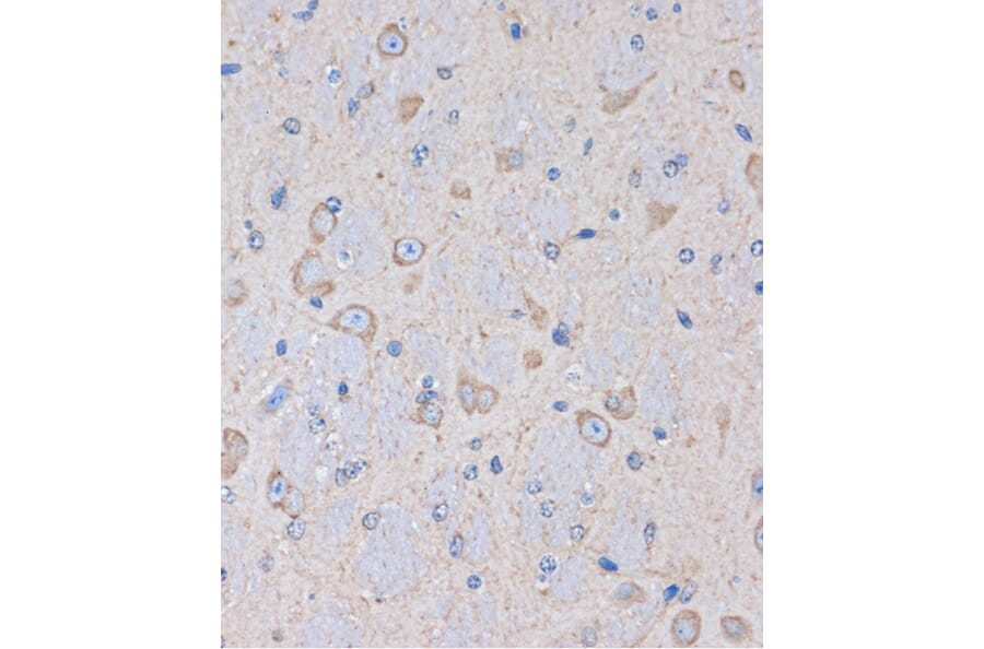 Immunohistochemistry - Anti-OR2S2 Antibody (A89342) - Antibodies.com
