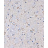 Immunohistochemistry - Anti-OR2S2 Antibody (A89342) - Antibodies.com